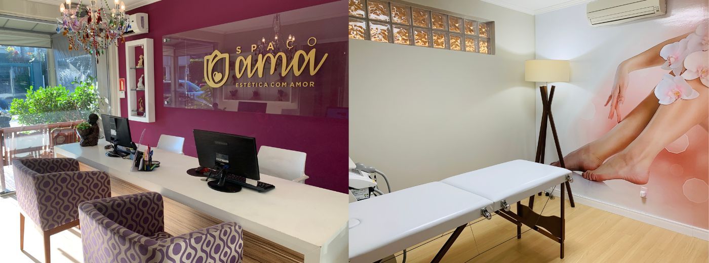 Aplicação de 20 Fios Lisos de PDO Alur®: escolha entre Olheiras, Linhas de Marionete, Glabela, Papada ou Pescoço